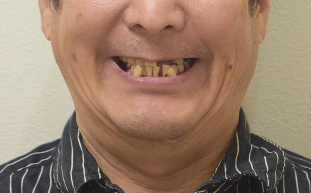 BEFORE