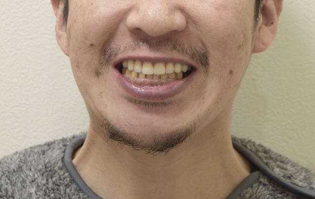 AFTER