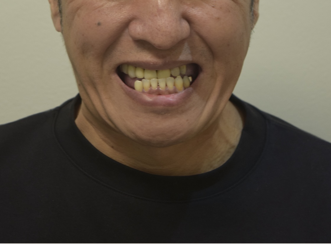 BEFORE