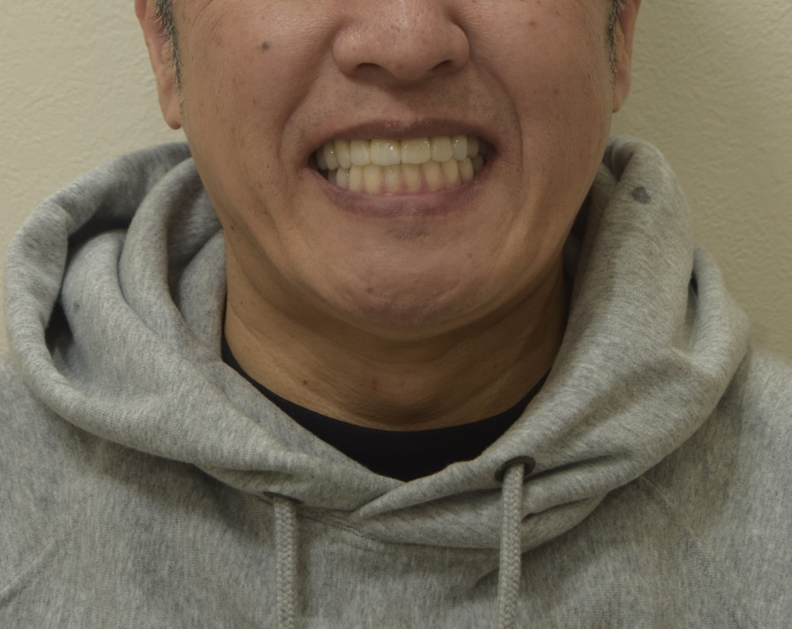 AFTER