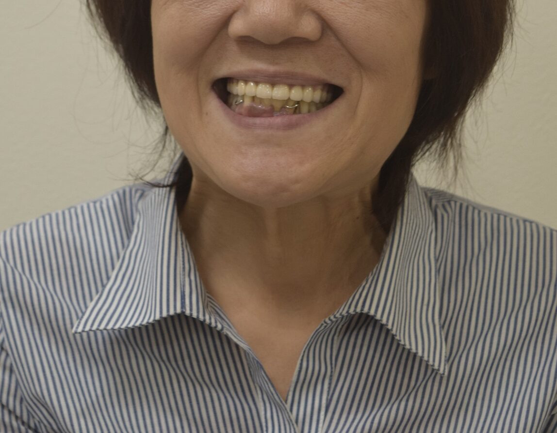 AFTER