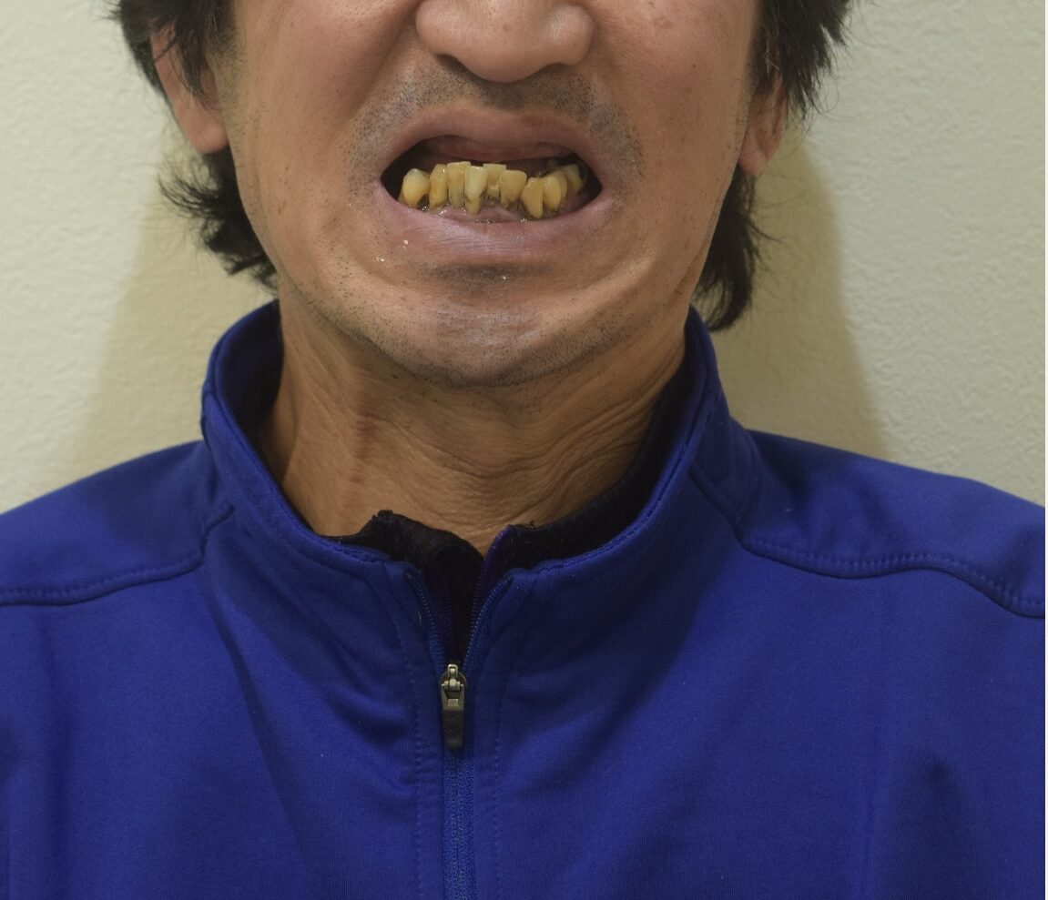 BEFORE