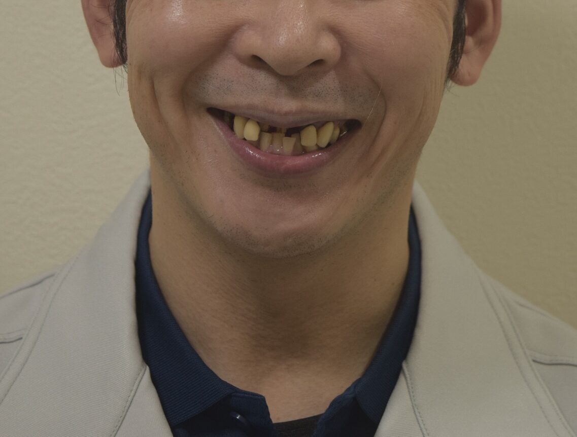 BEFORE