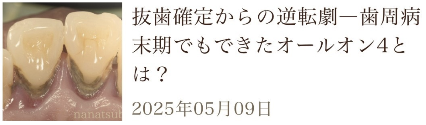 関連記事2