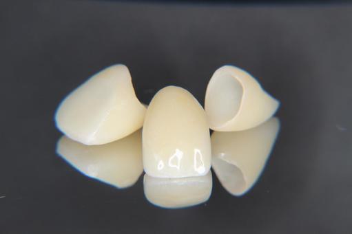 被せ物の作り直し