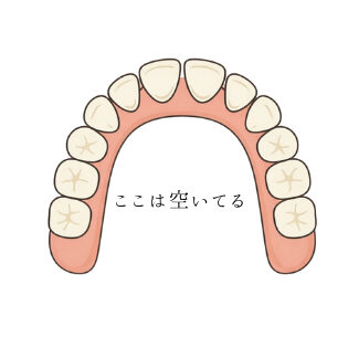 オールオン4の場合