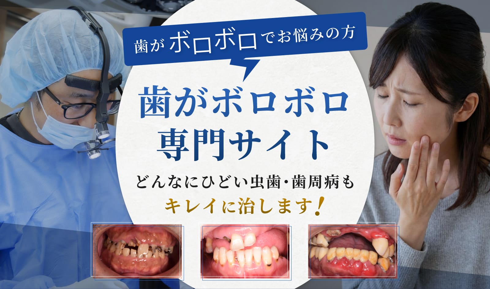 歯がボロボロ専門サイト