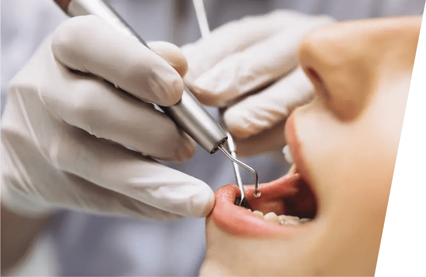 2：虫歯だらけ、歯が無いお口の中をみられるのが恥ずかしくて、口を開けれるだろうか？